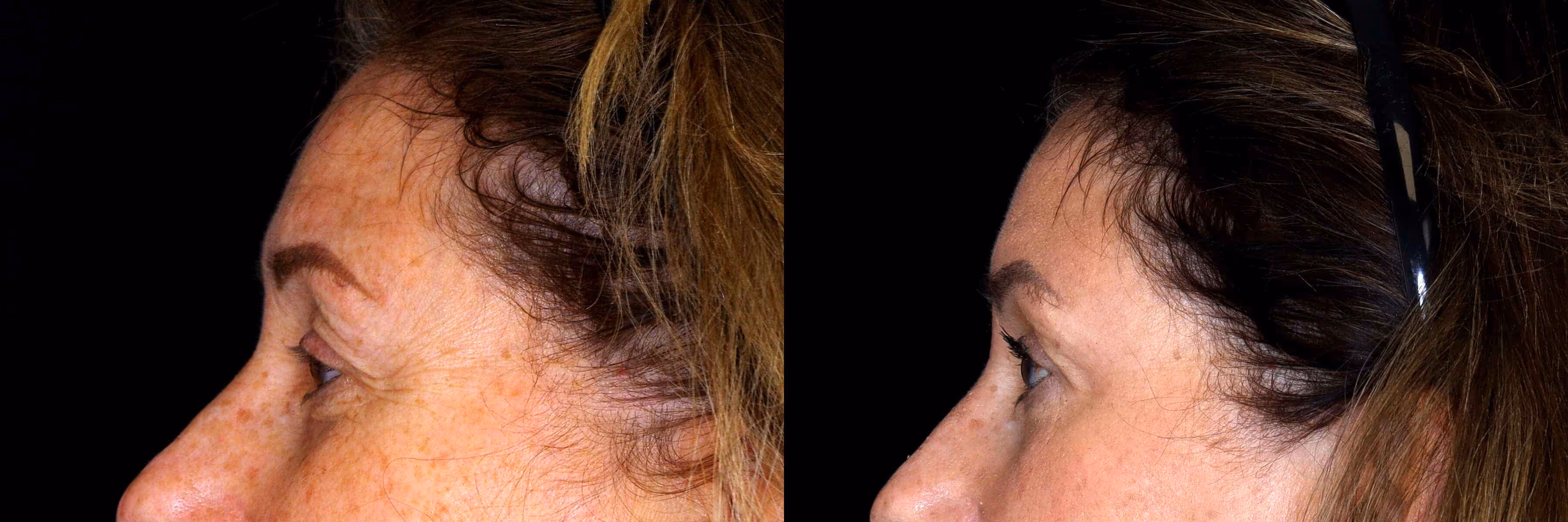 Before And After Patient Image