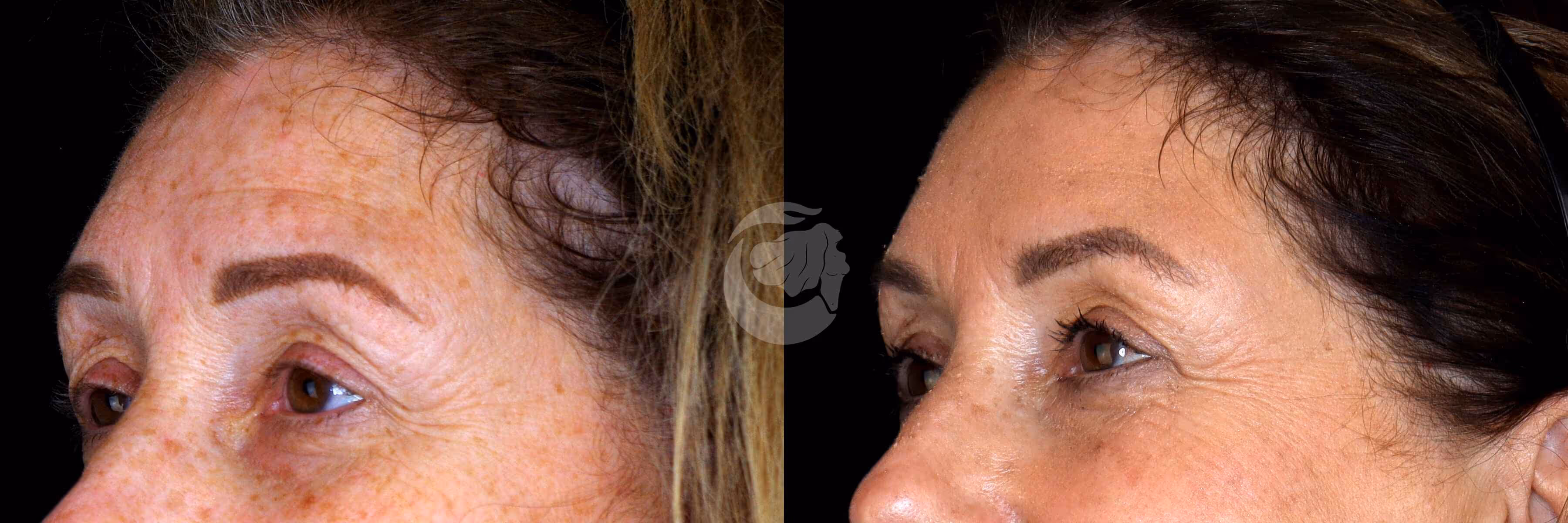 Before And After Patient Image