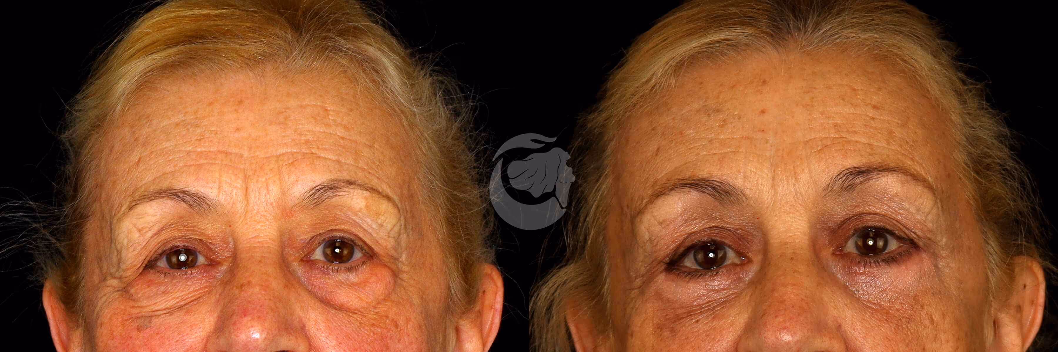 Before And After Patient Image