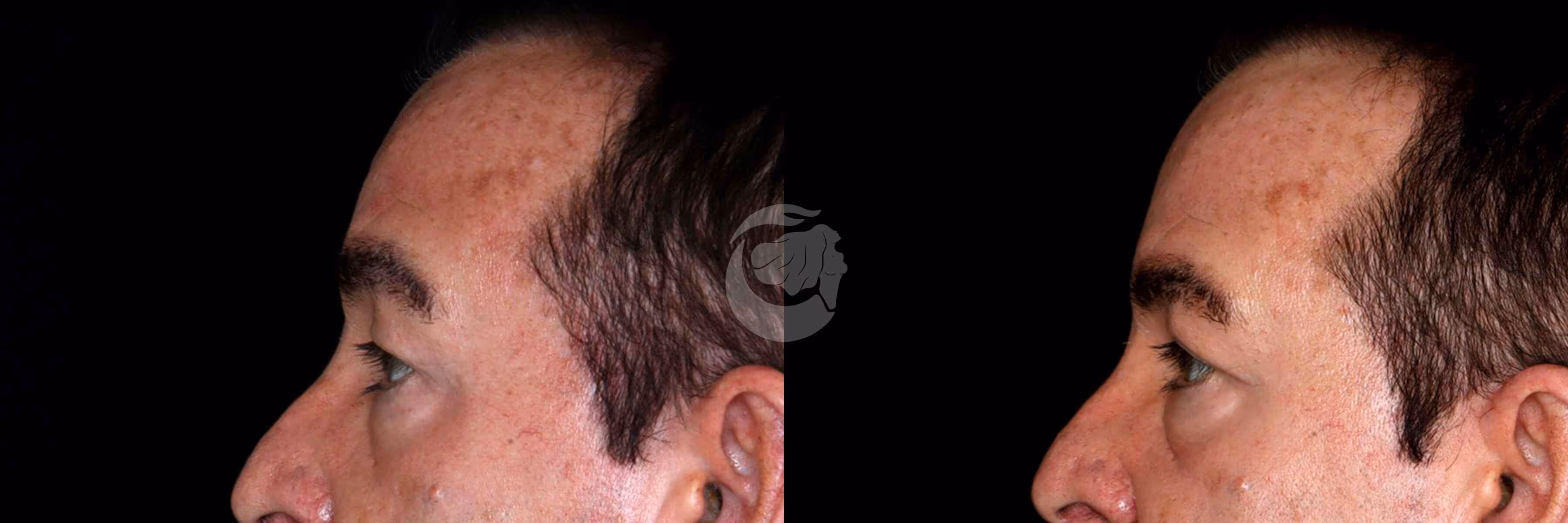 Before And After Patient Image