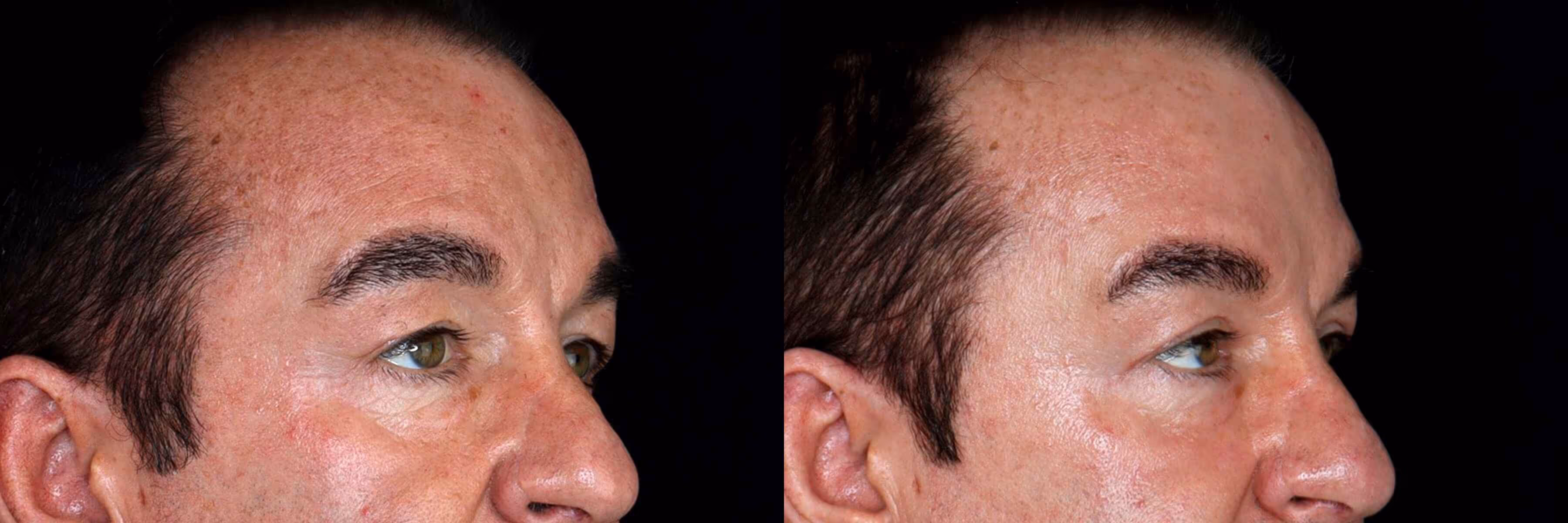 Before And After Patient Image