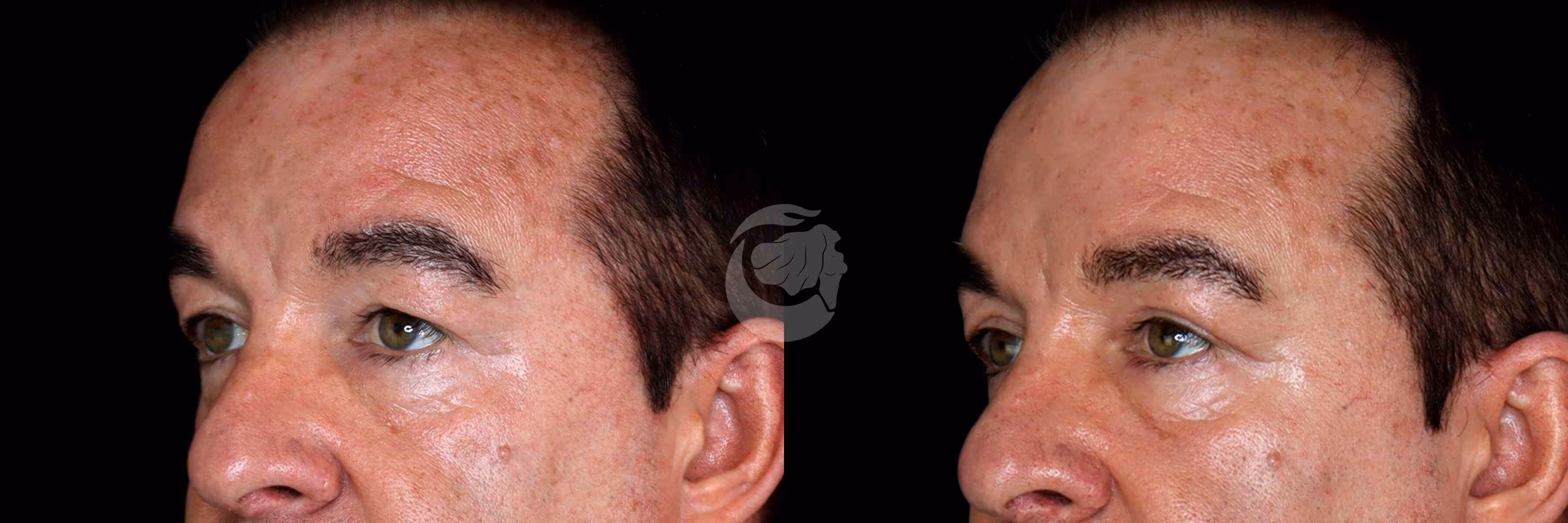 Before And After Patient Image