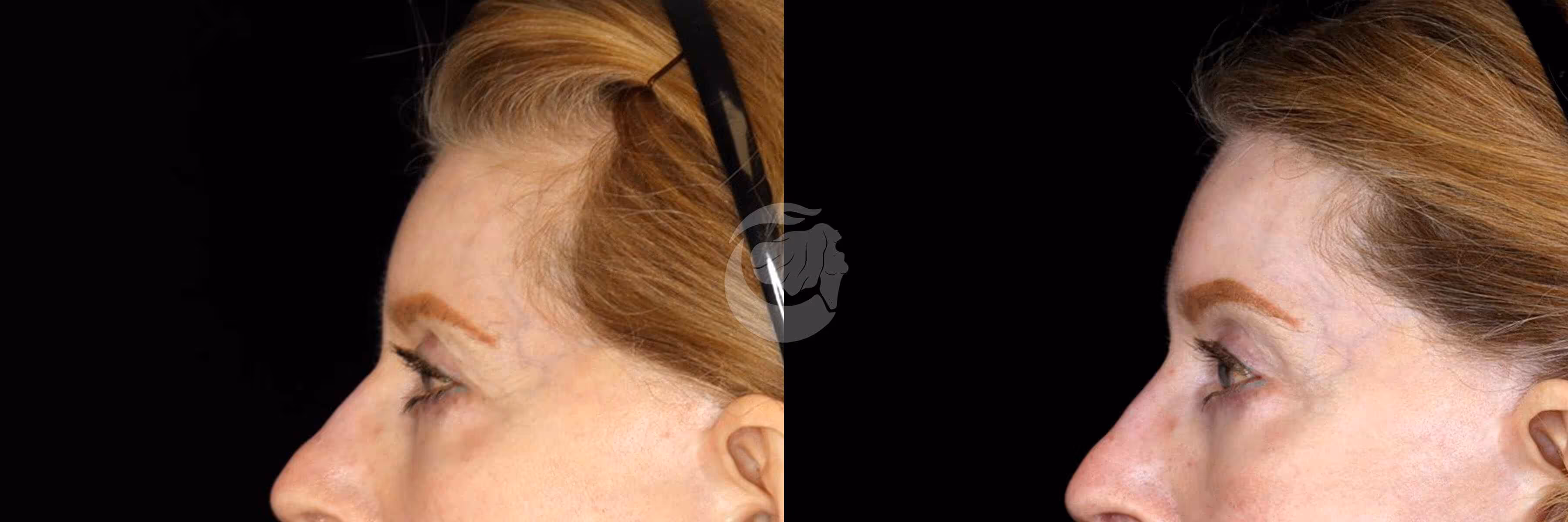 Before And After Patient Image