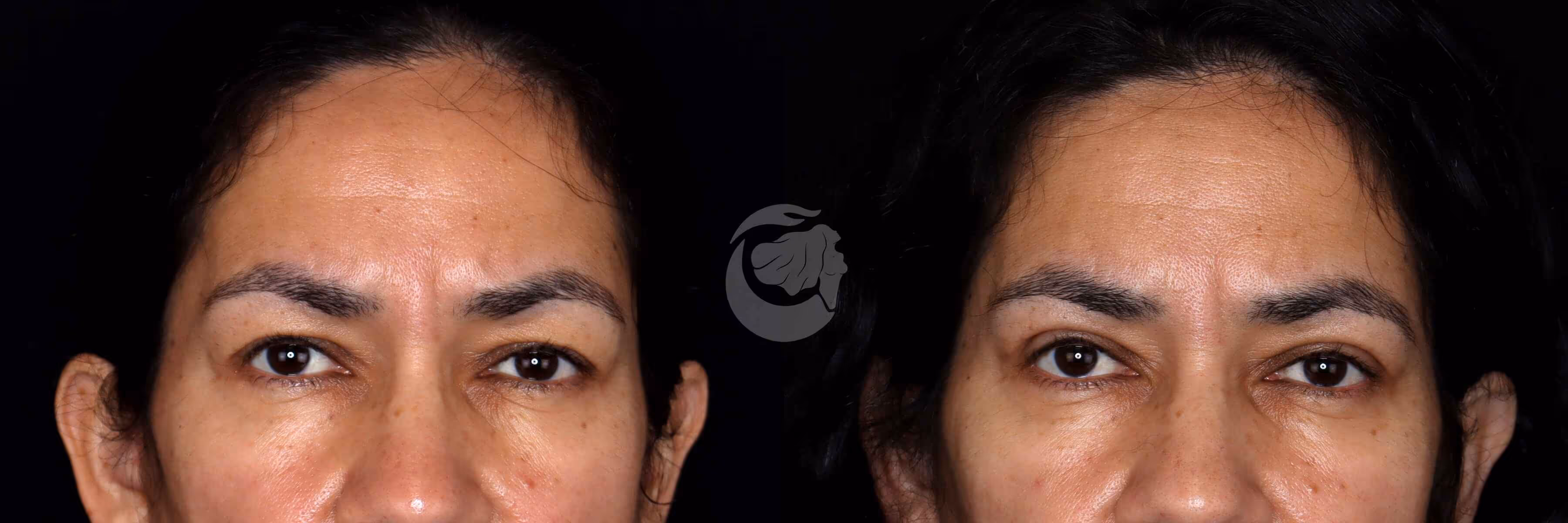 Before And After Patient Image