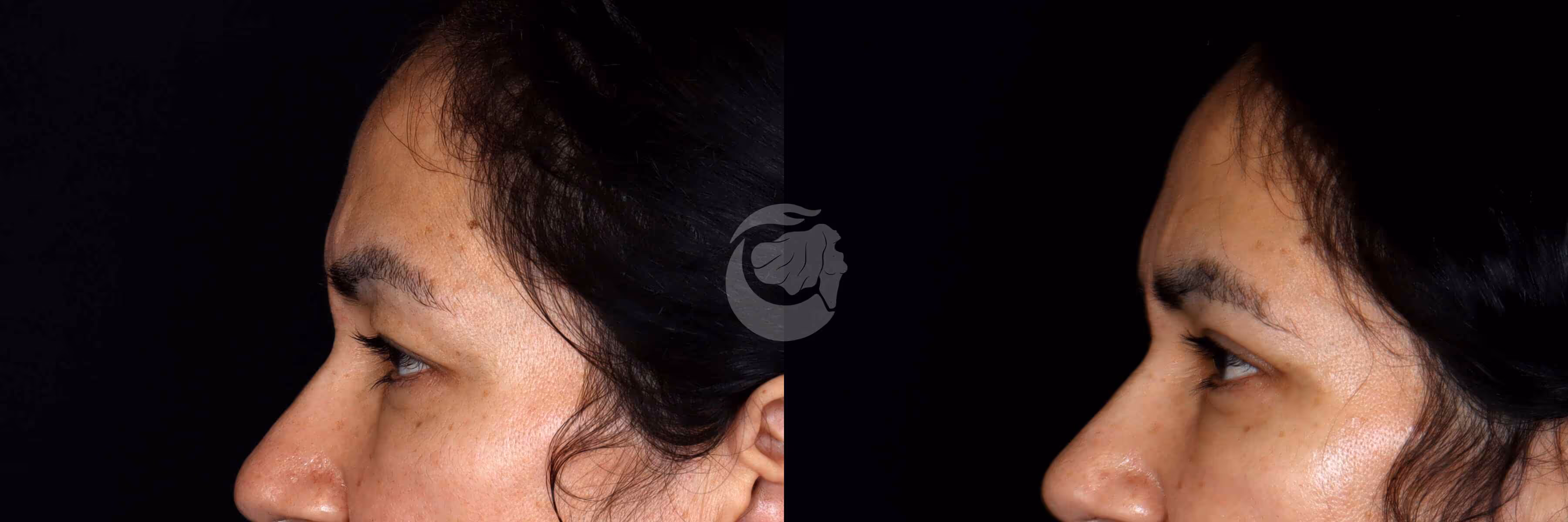 Before And After Patient Image