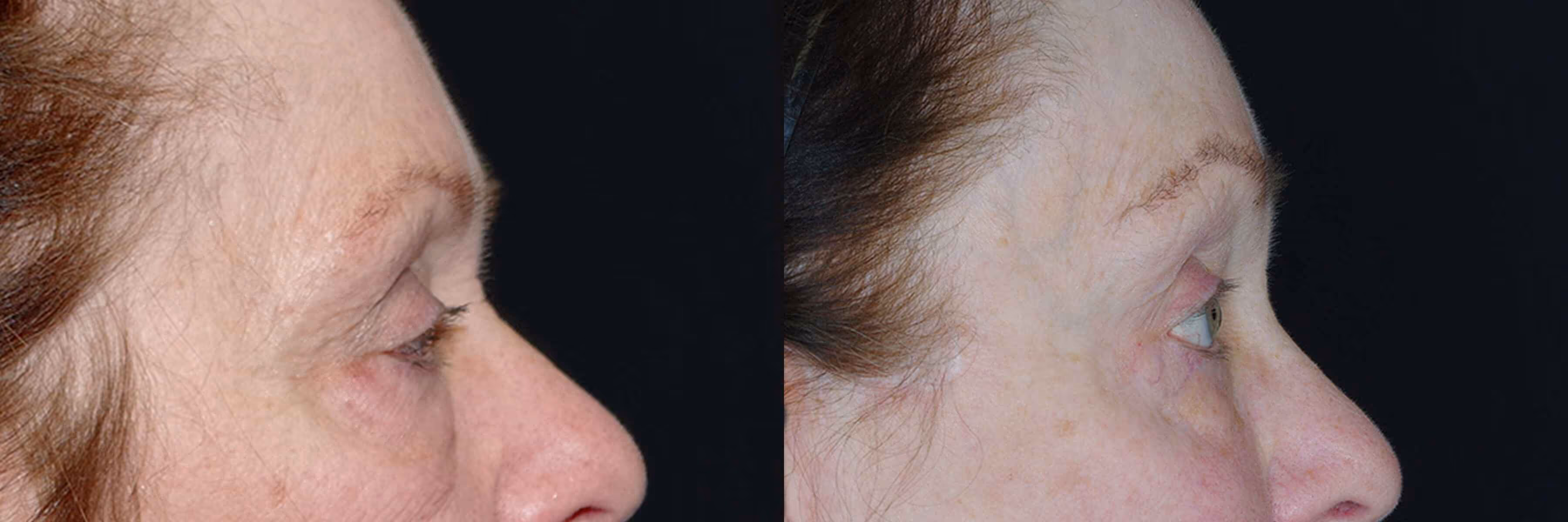 Before And After Patient Image