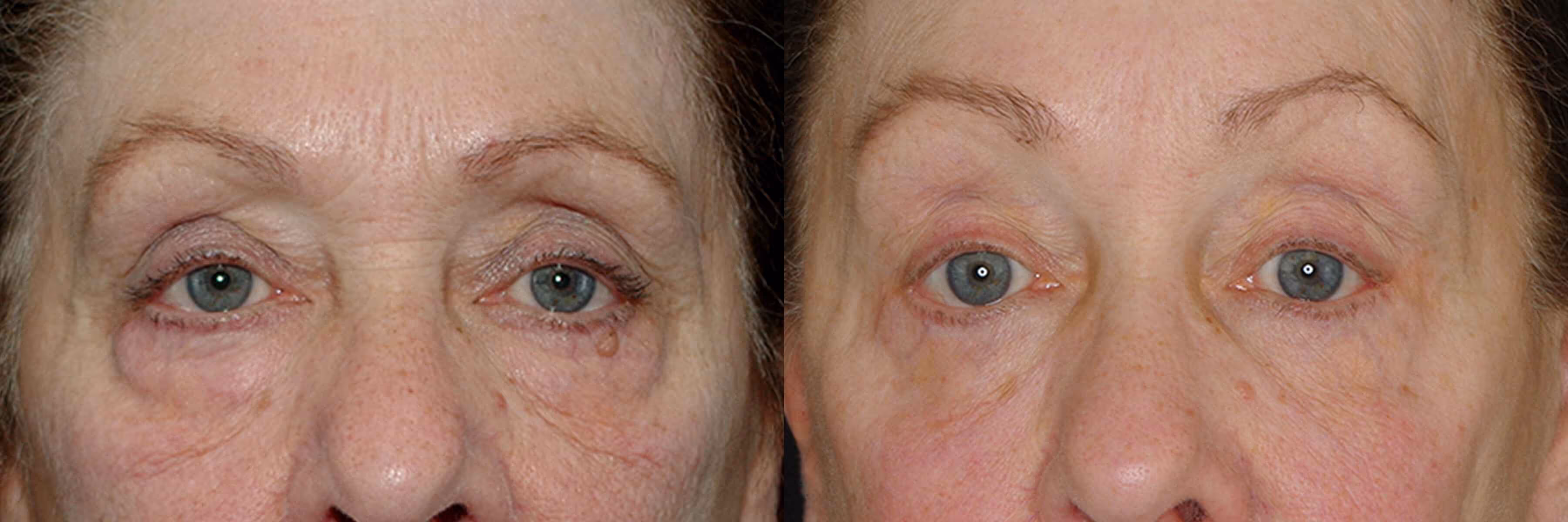 Before And After Patient Image