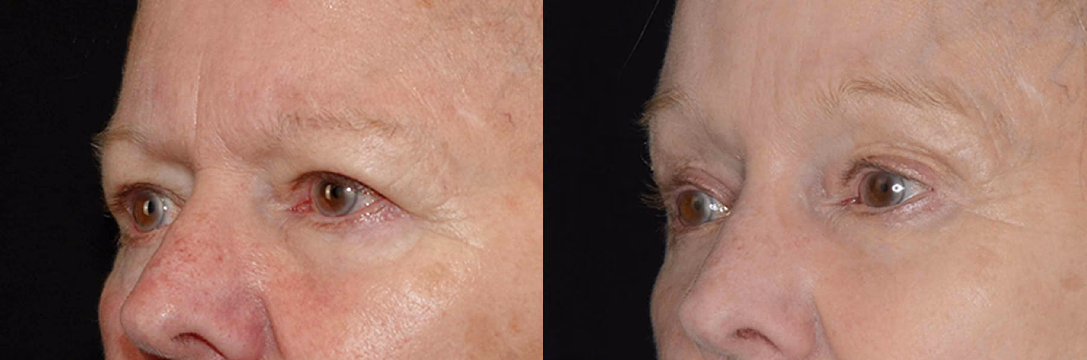 Before And After Patient Image