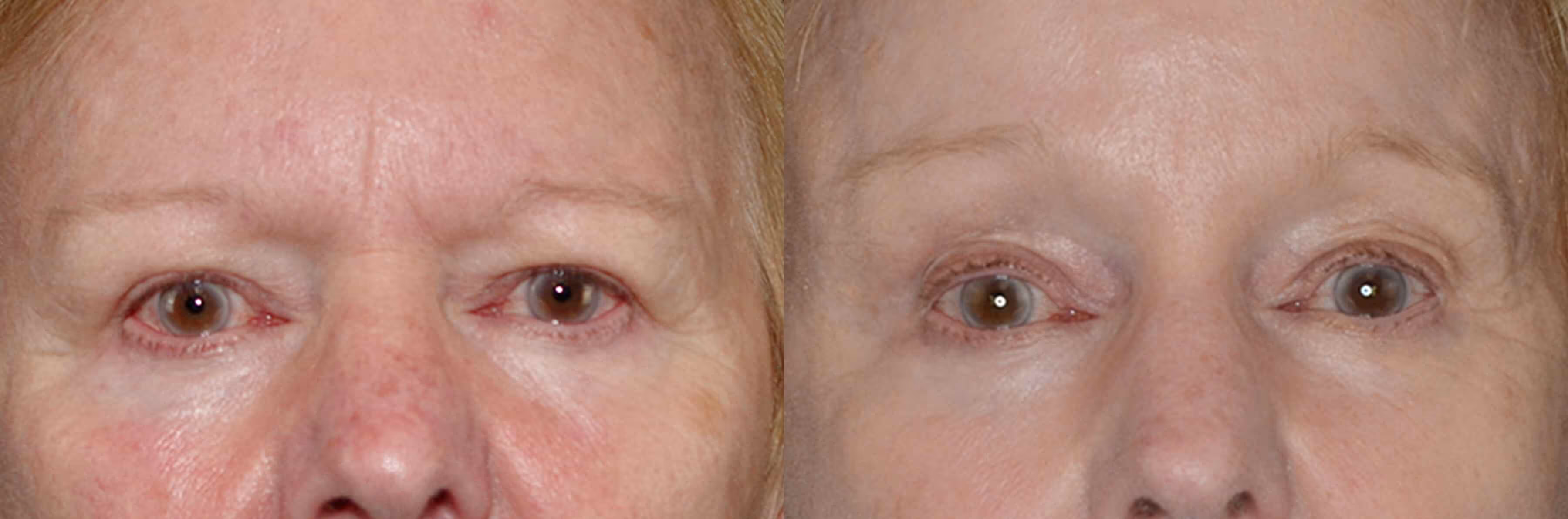 Before And After Patient Image