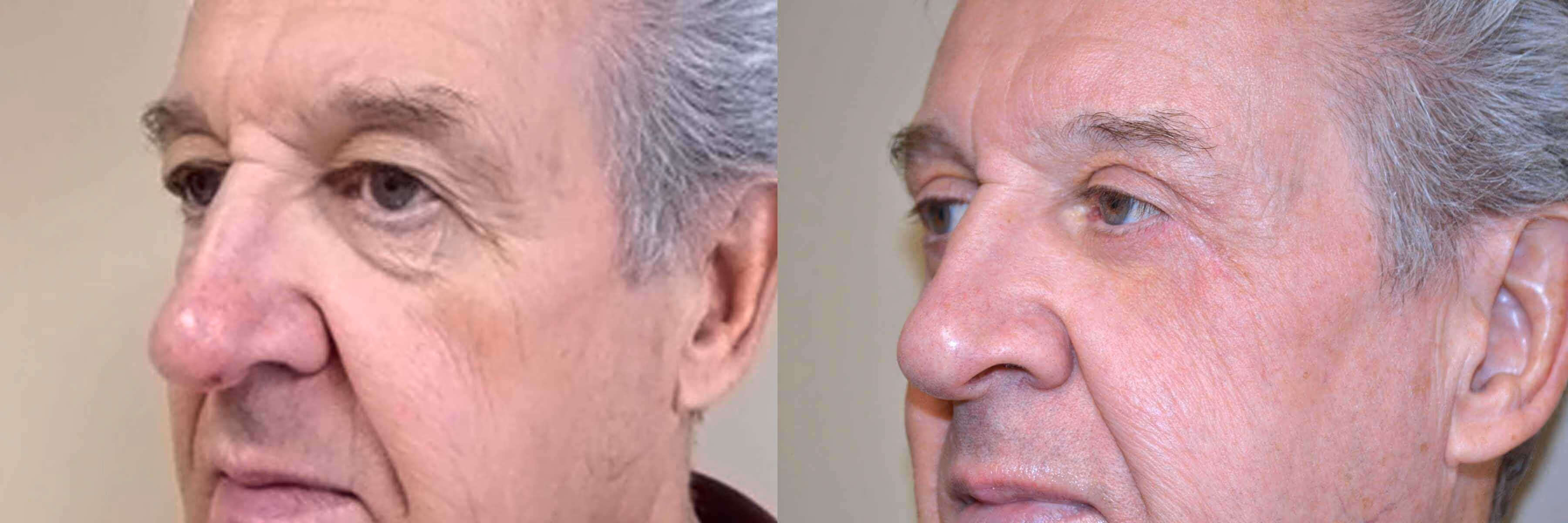 Before And After Patient Image