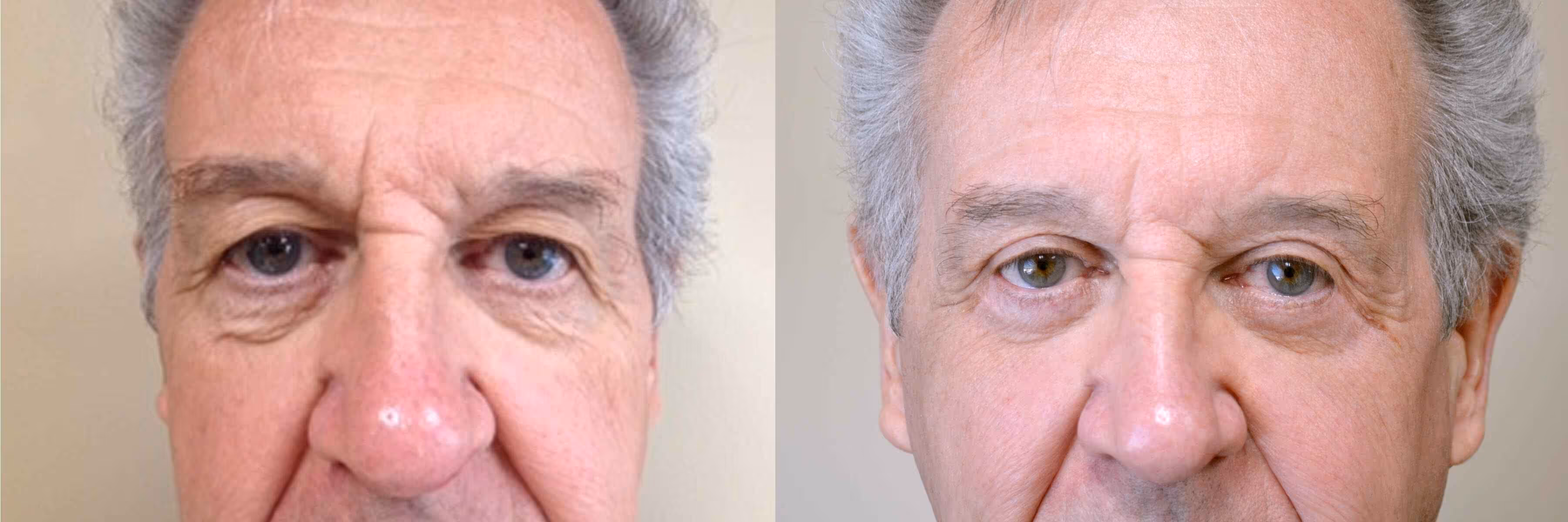 Before And After Patient Image