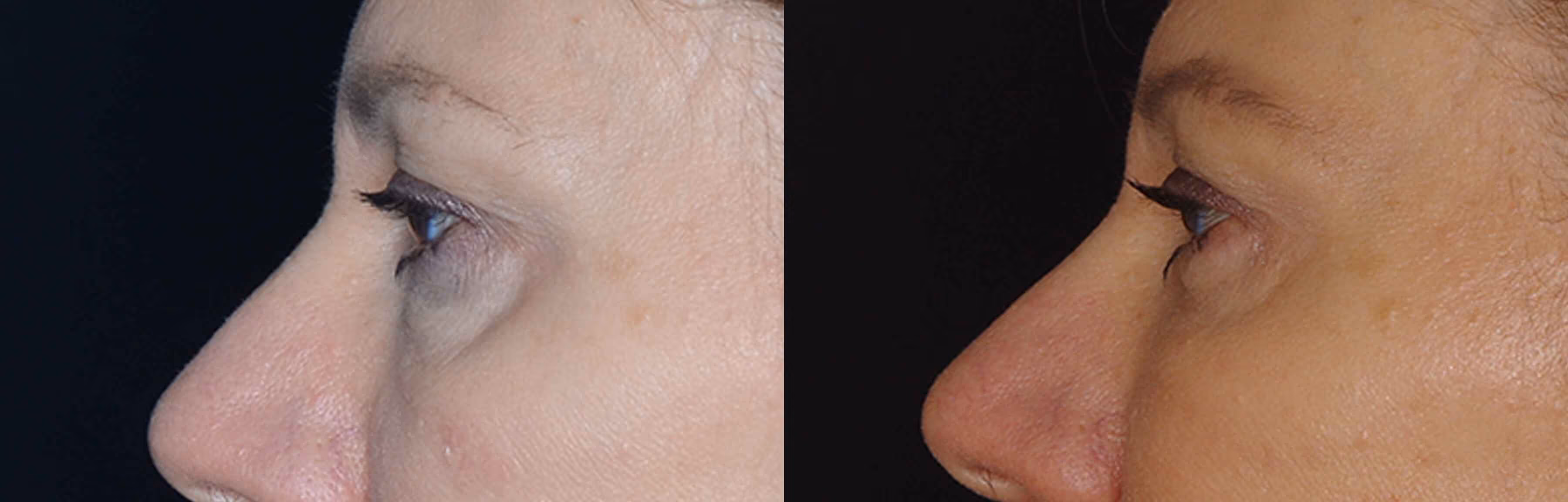 Before And After Patient Image