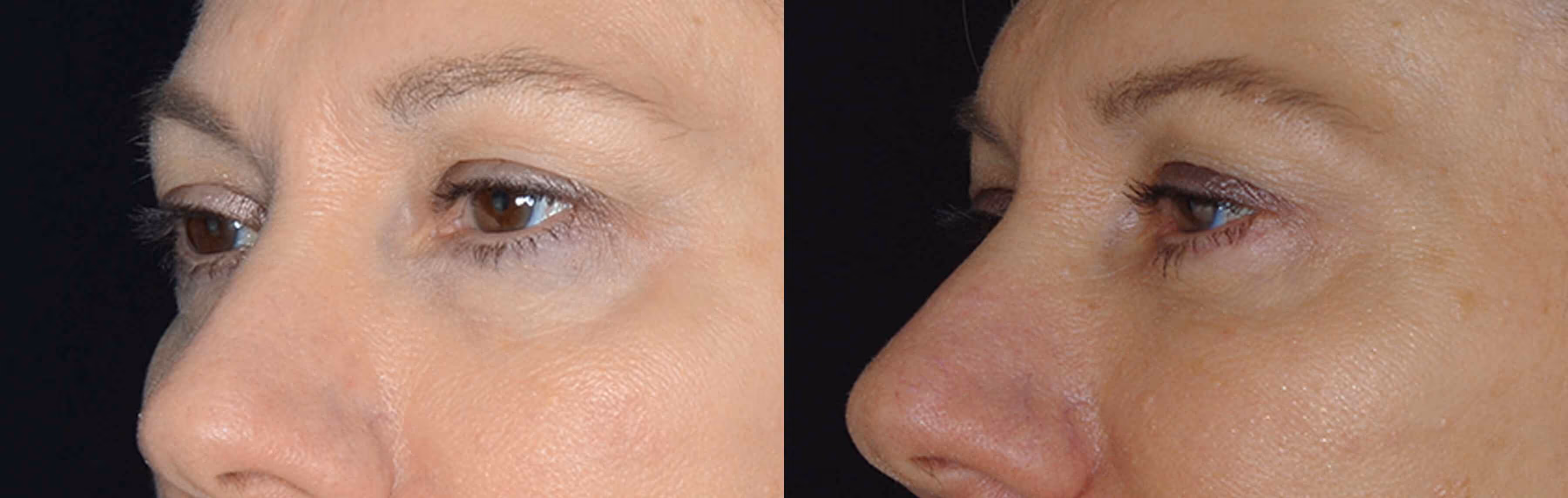 Before And After Patient Image