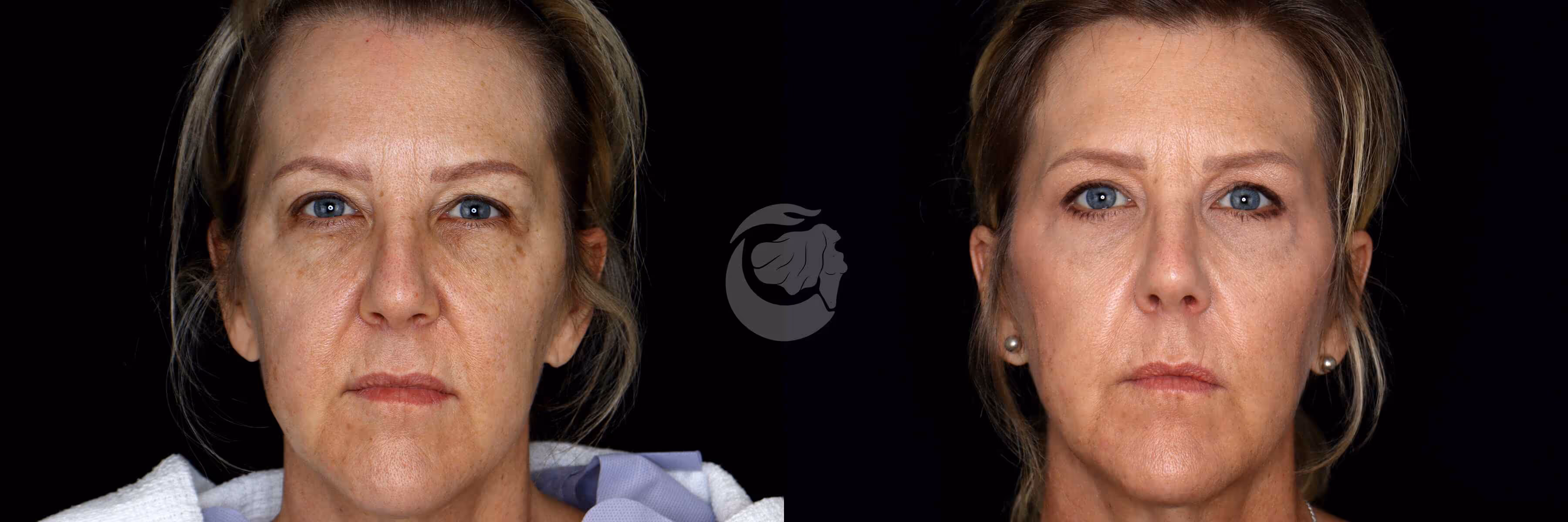 Before And After Patient Image