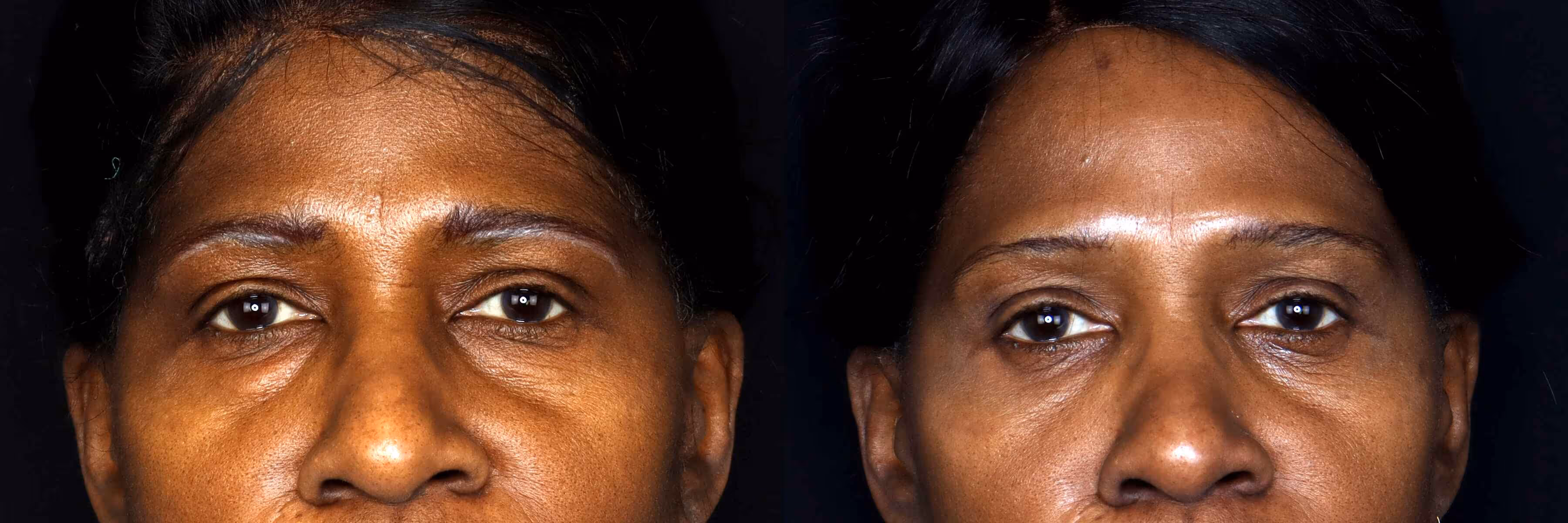 Before And After Patient Image