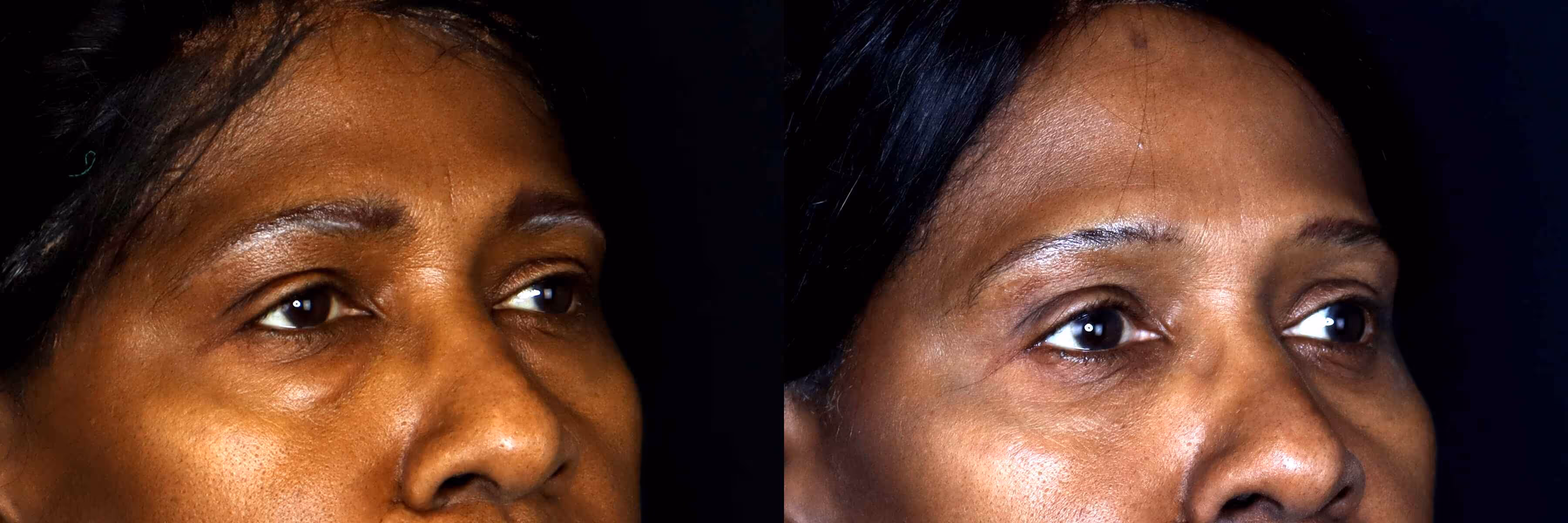 Before And After Patient Image
