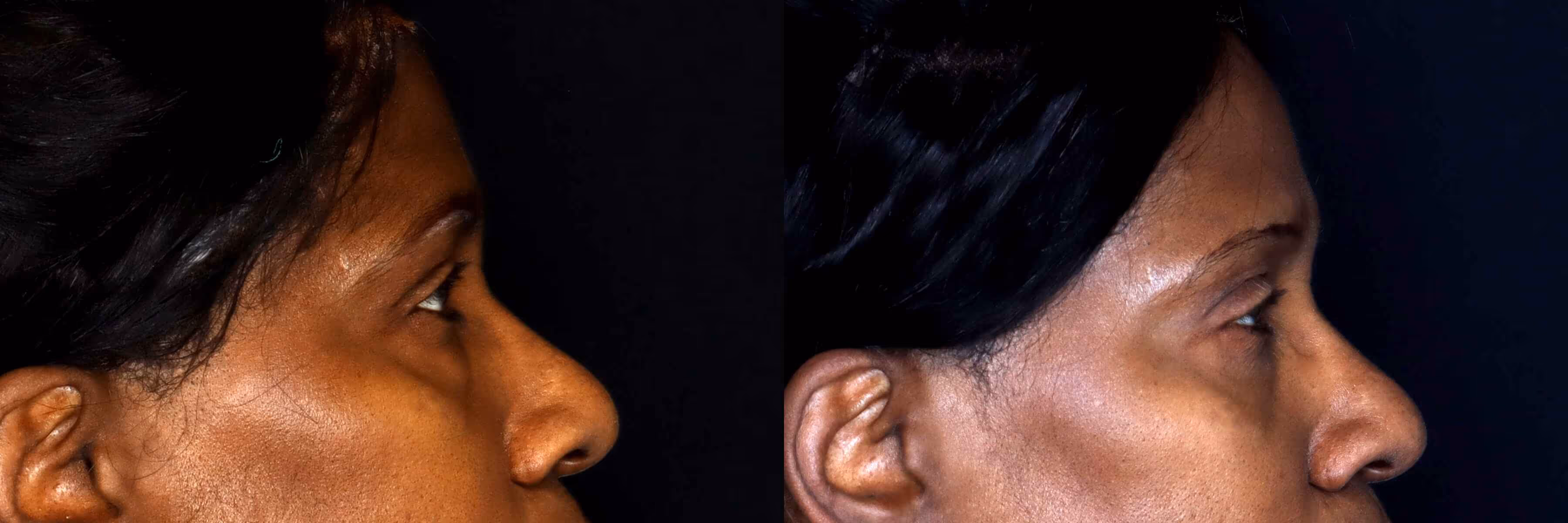 Before And After Patient Image