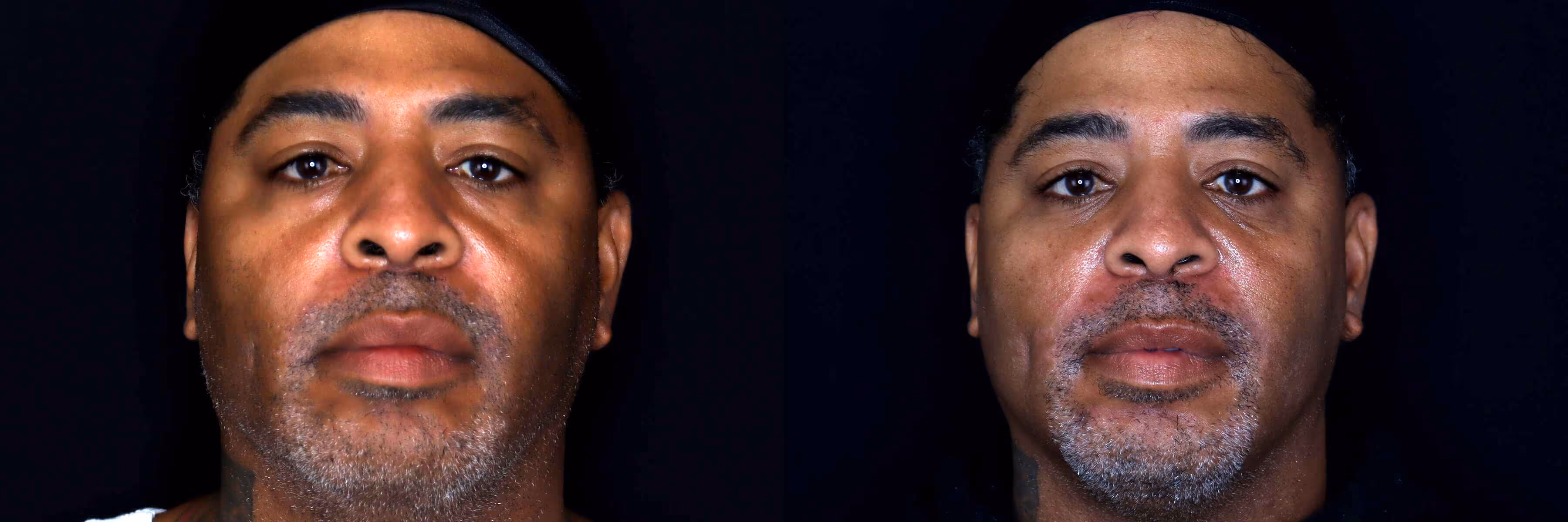 Before And After Patient Image