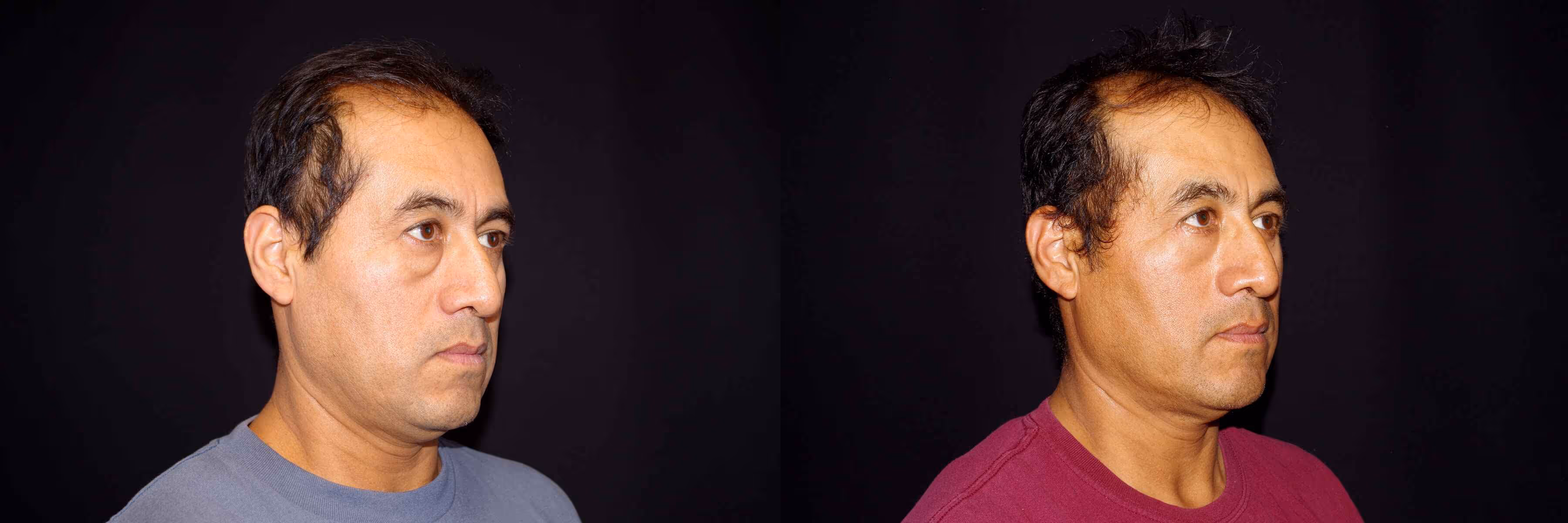 Before And After Patient Image