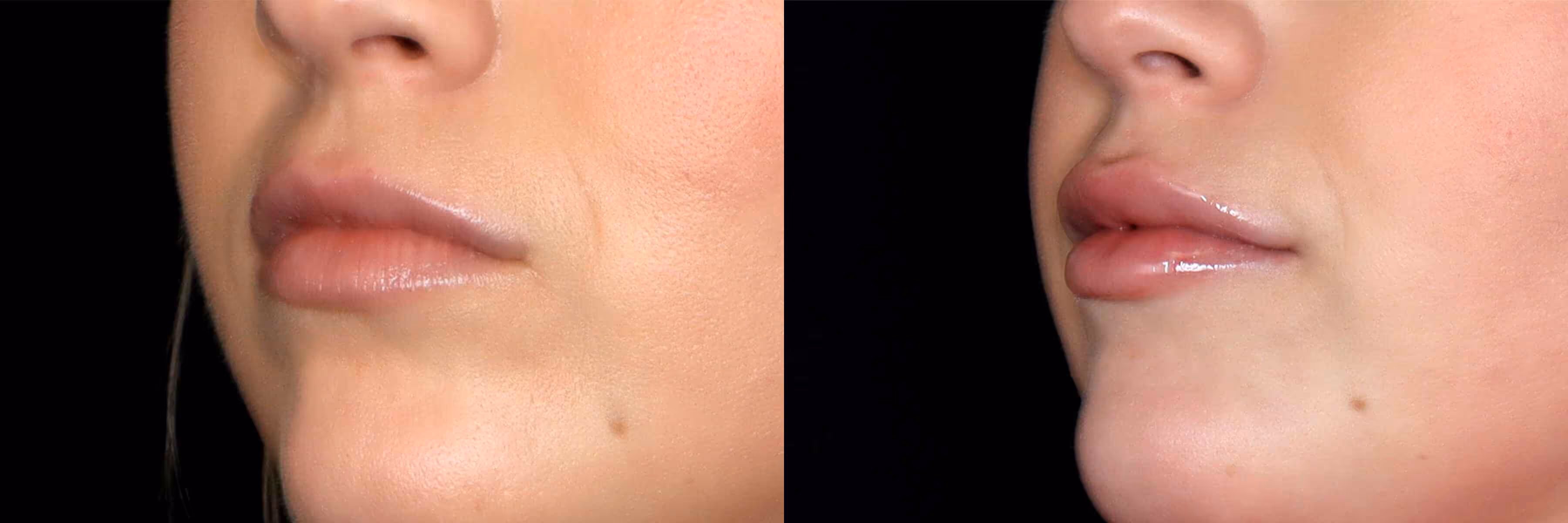 Before And After Patient Image