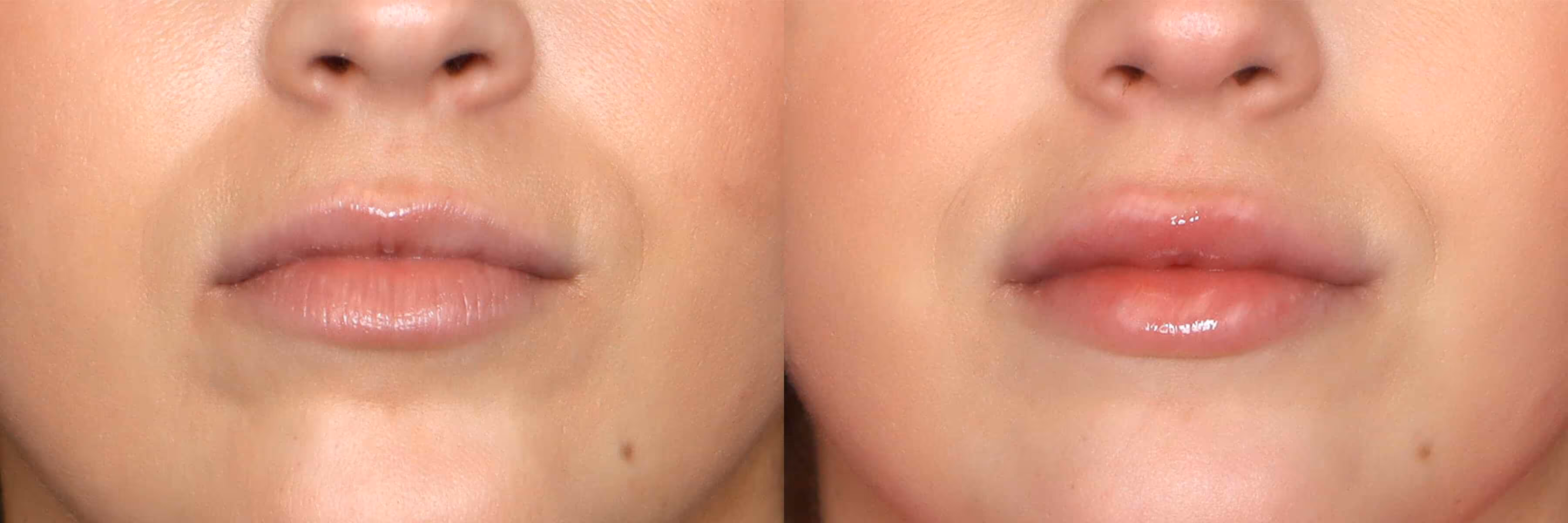 Before And After Patient Image