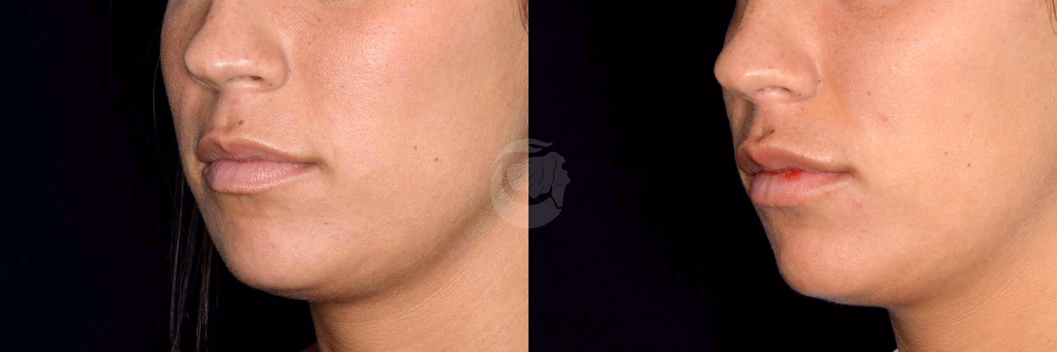 Before And After Patient Image