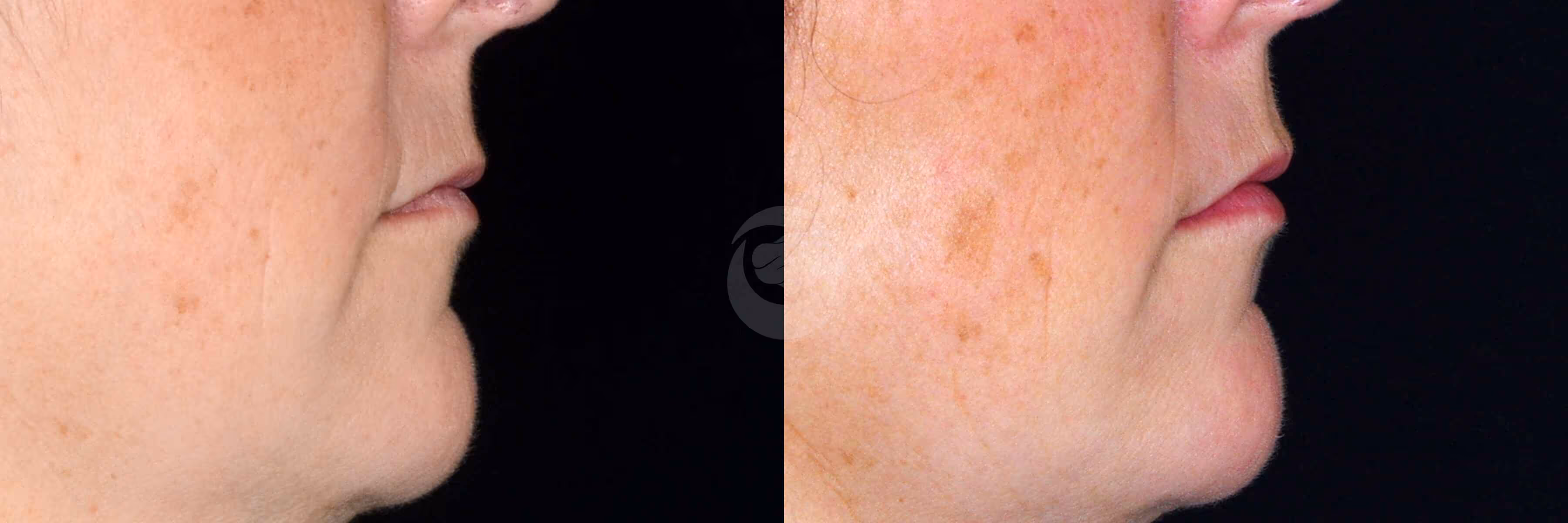 Before And After Patient Image