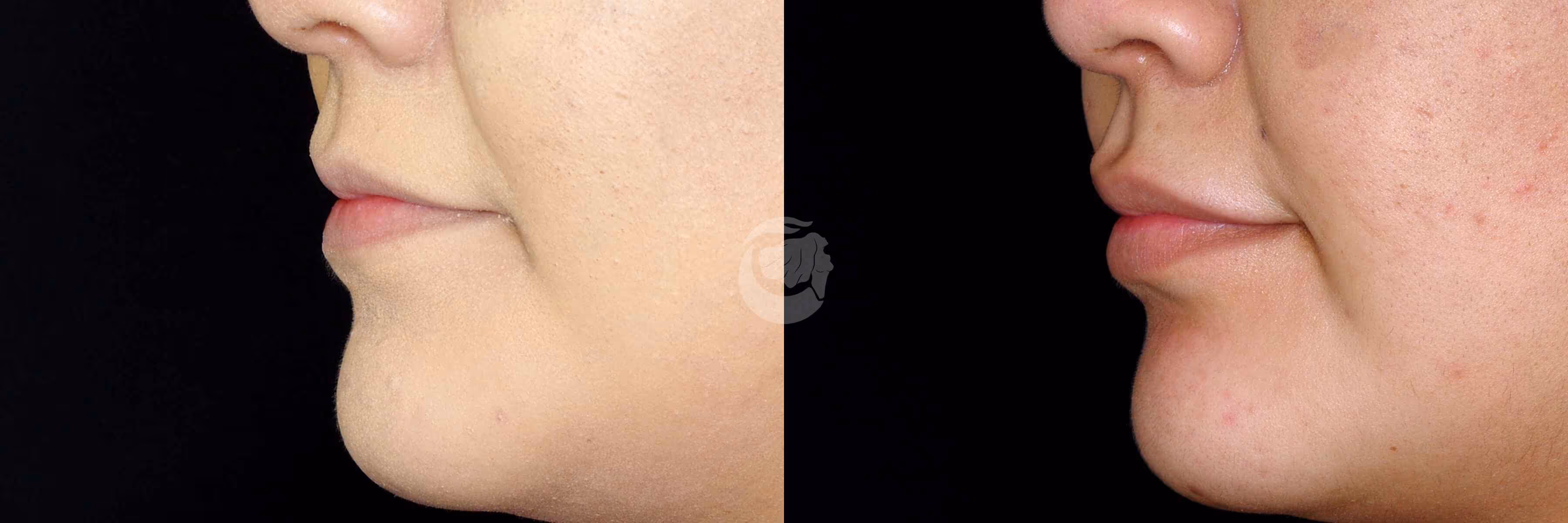 Before And After Patient Image
