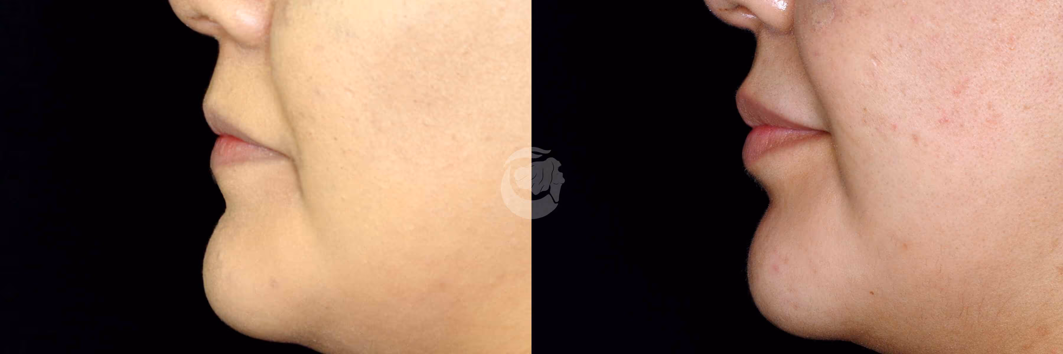 Before And After Patient Image