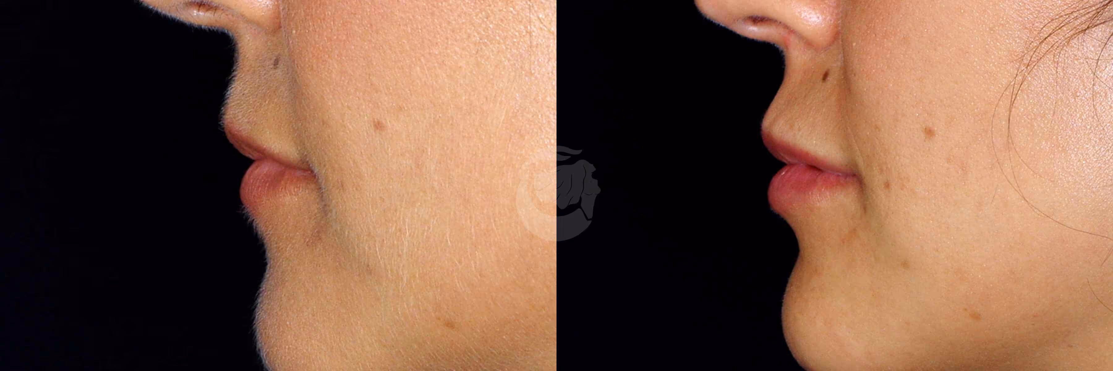 Before And After Patient Image