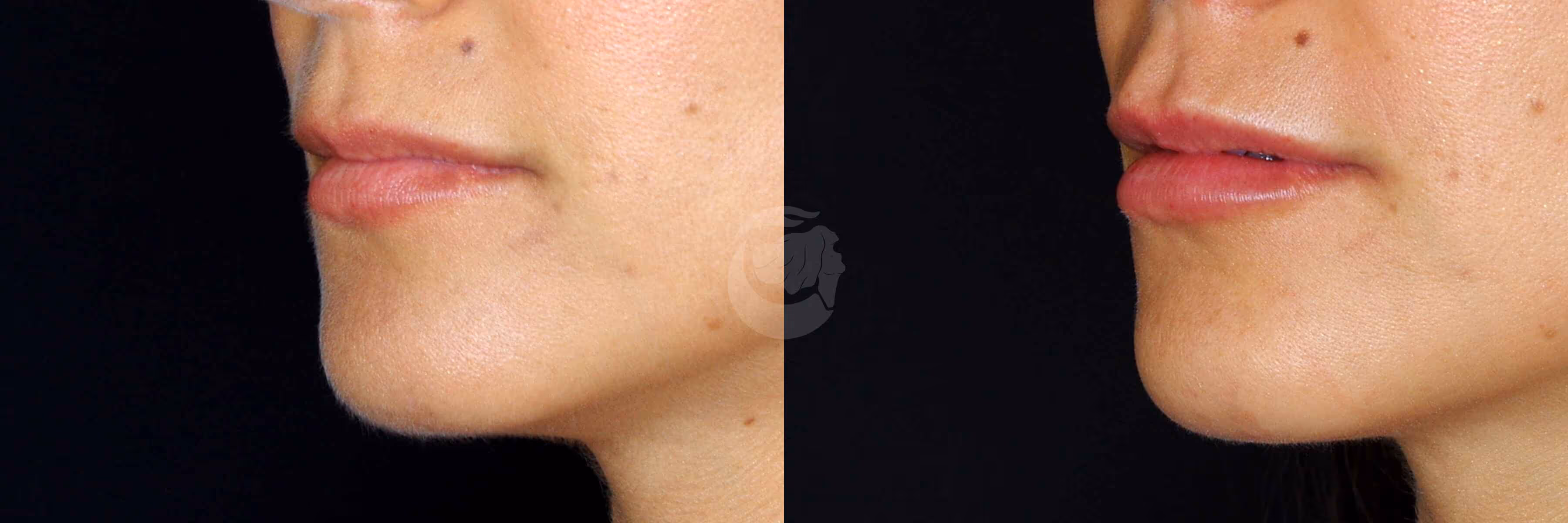 Before And After Patient Image