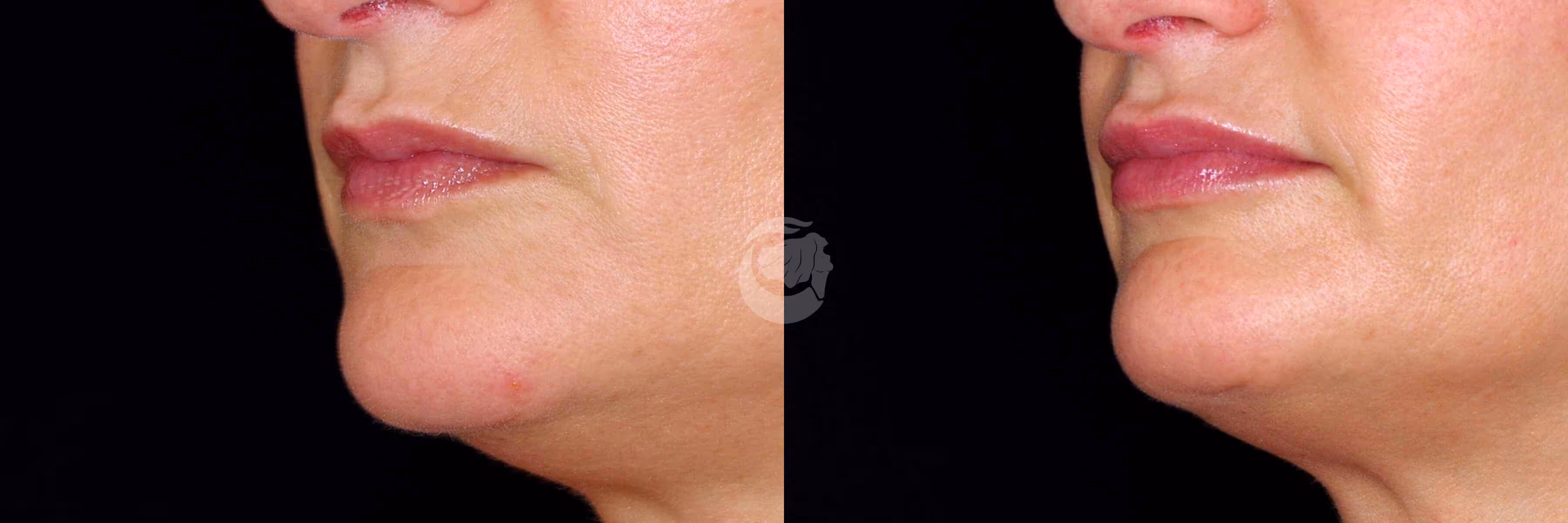 Before And After Patient Image