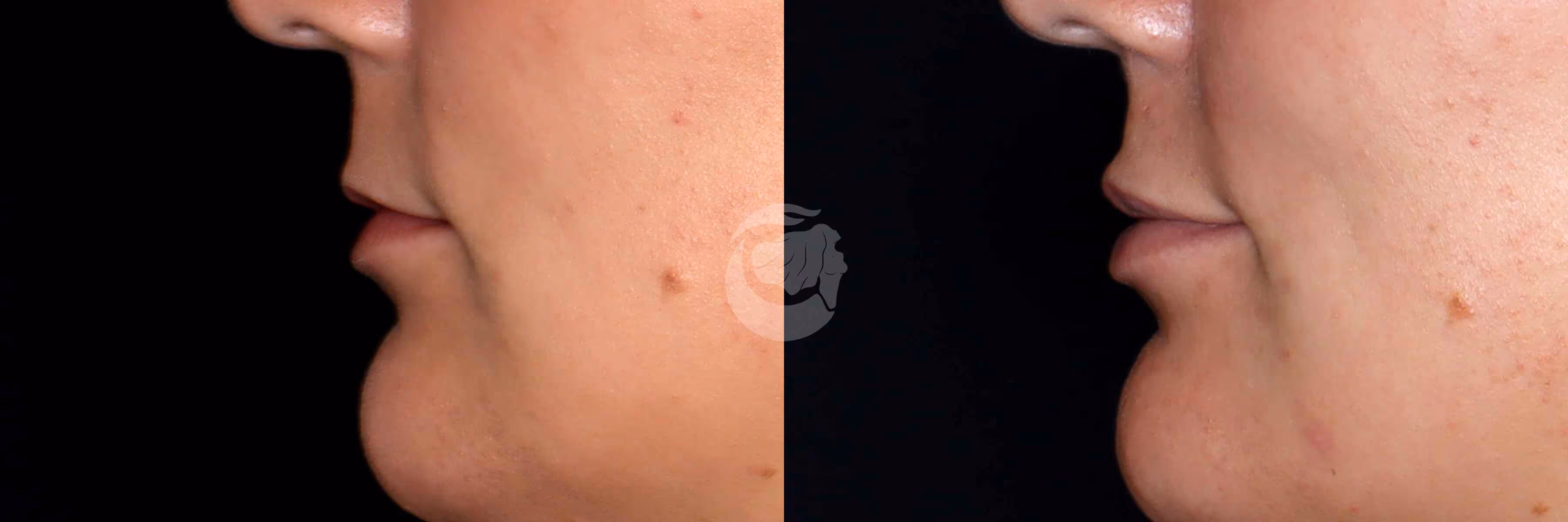 Before And After Patient Image