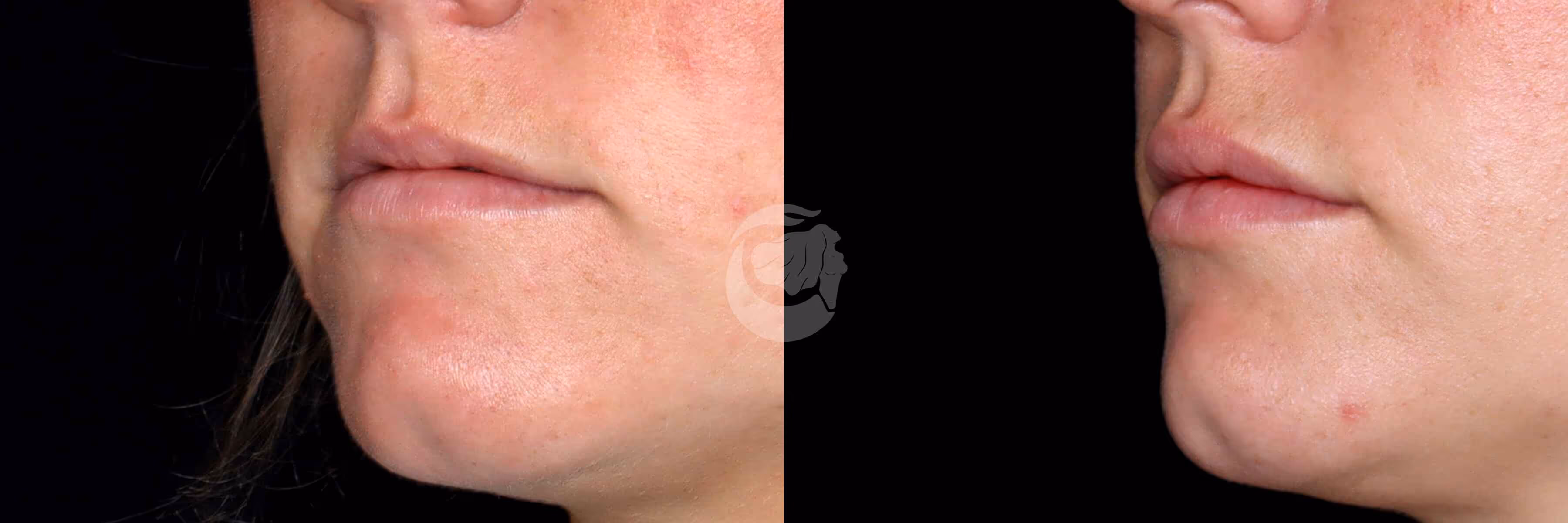 Before And After Patient Image