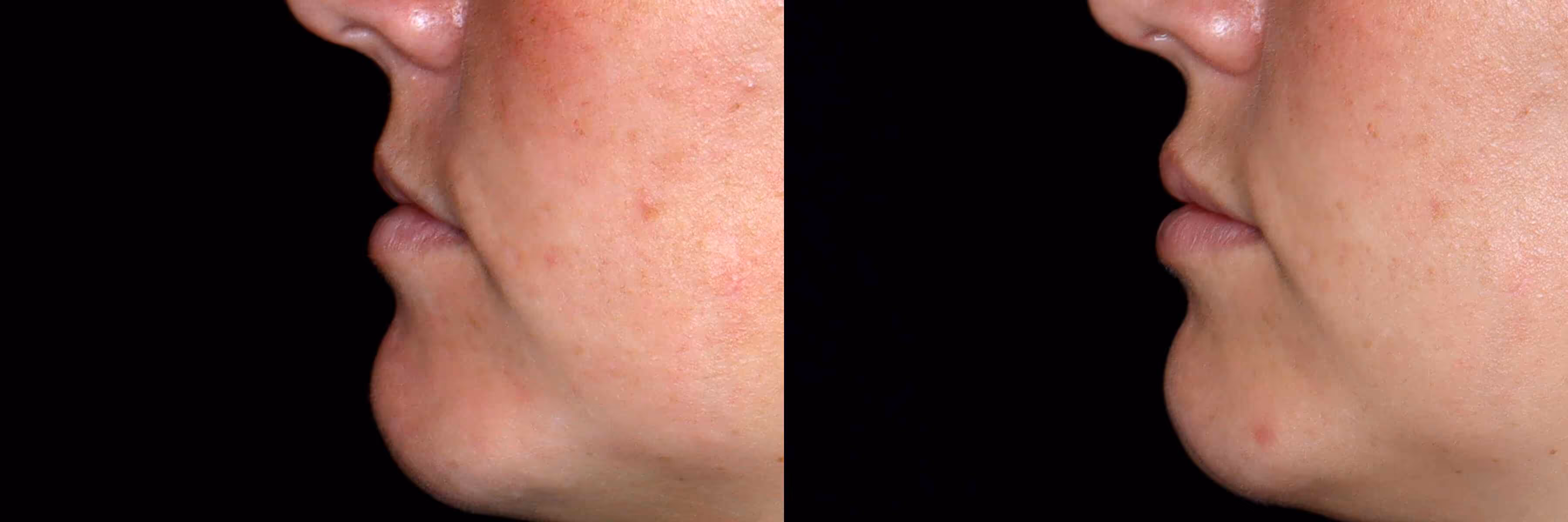 Before And After Patient Image