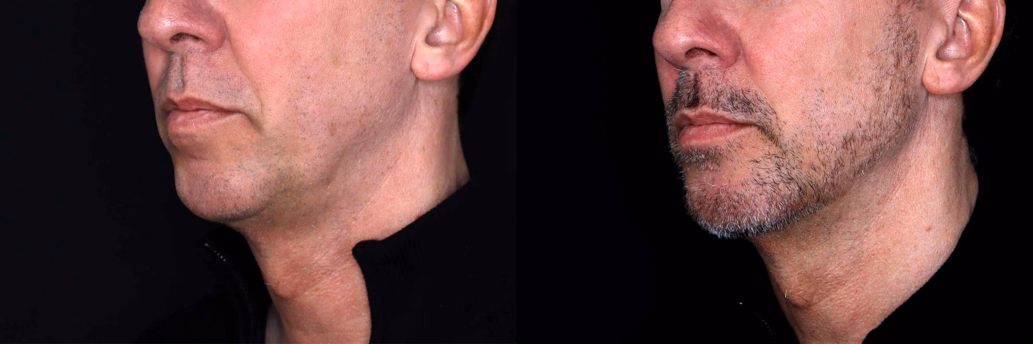 Before And After Patient Image