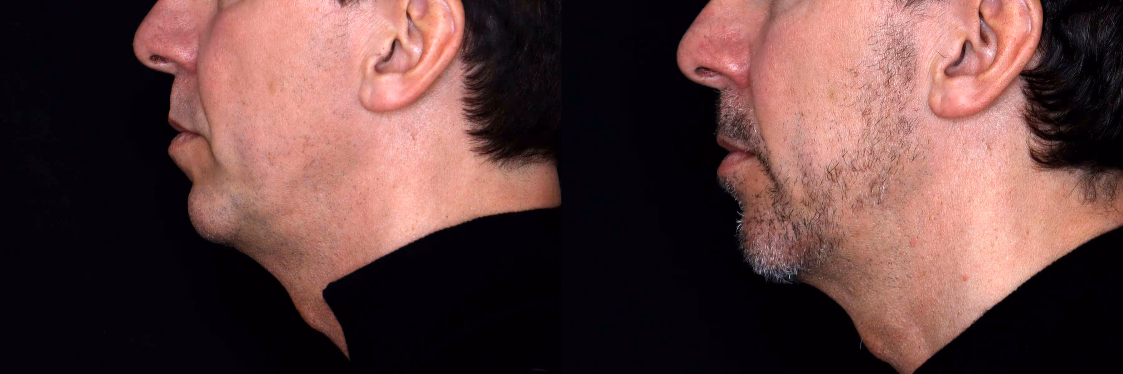 Before And After Patient Image
