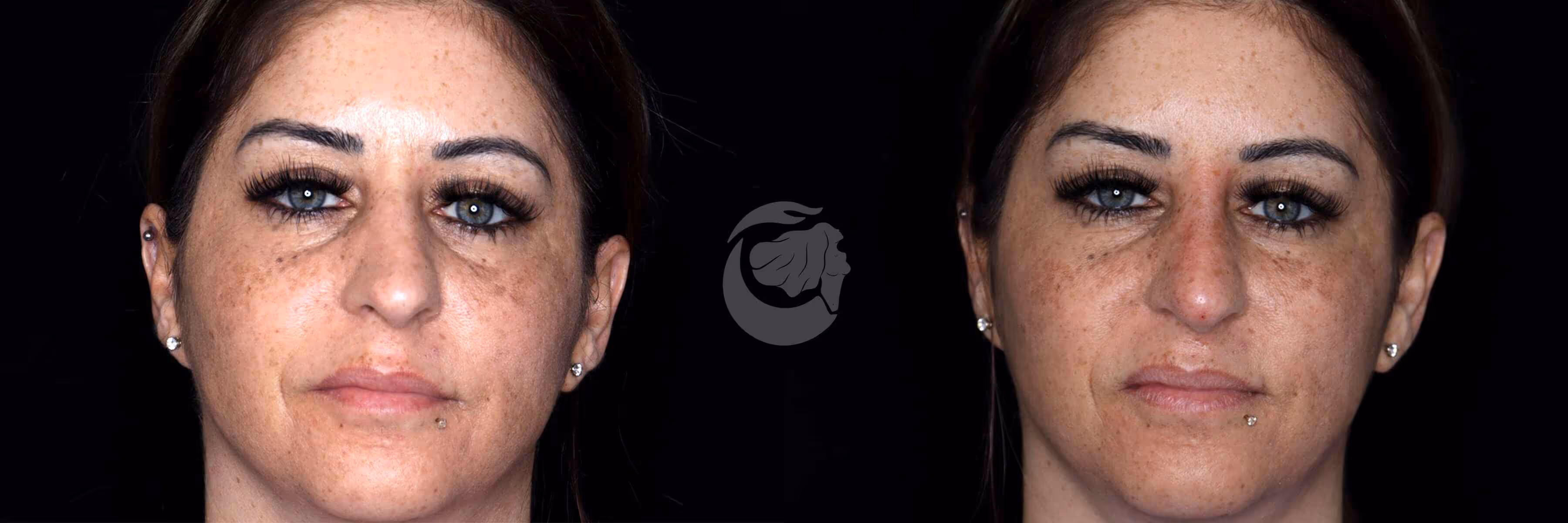 Before And After Patient Image