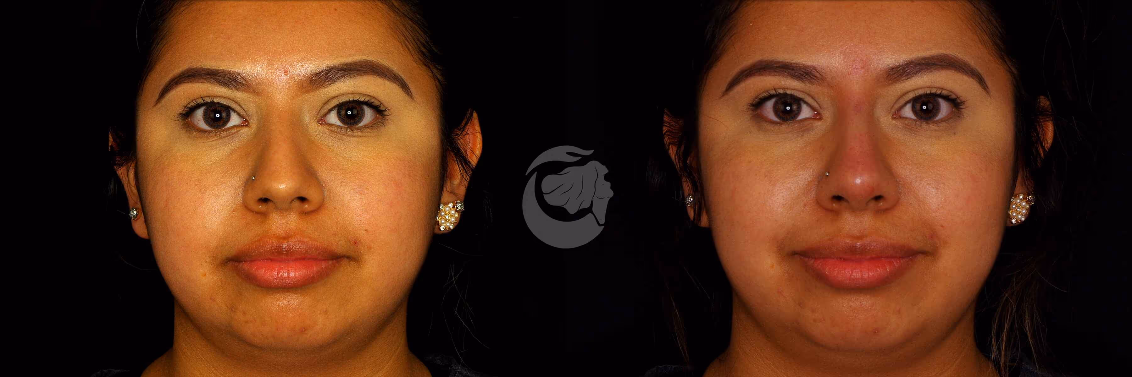Before And After Patient Image