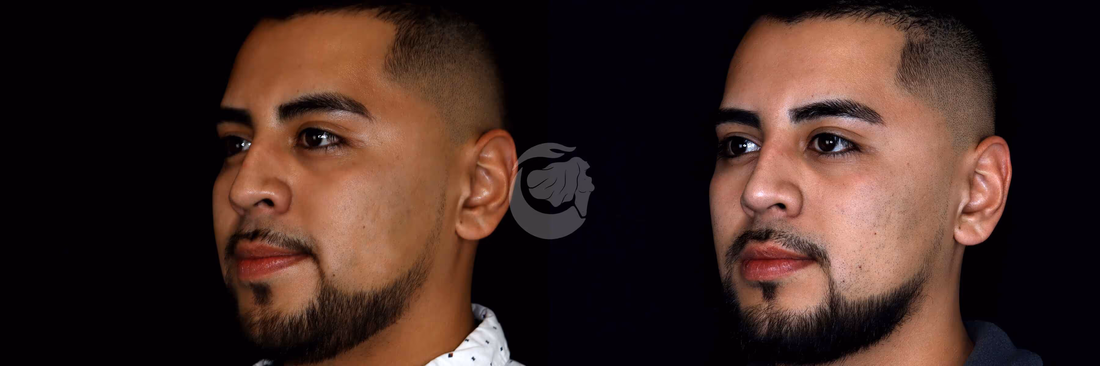 Before And After Patient Image