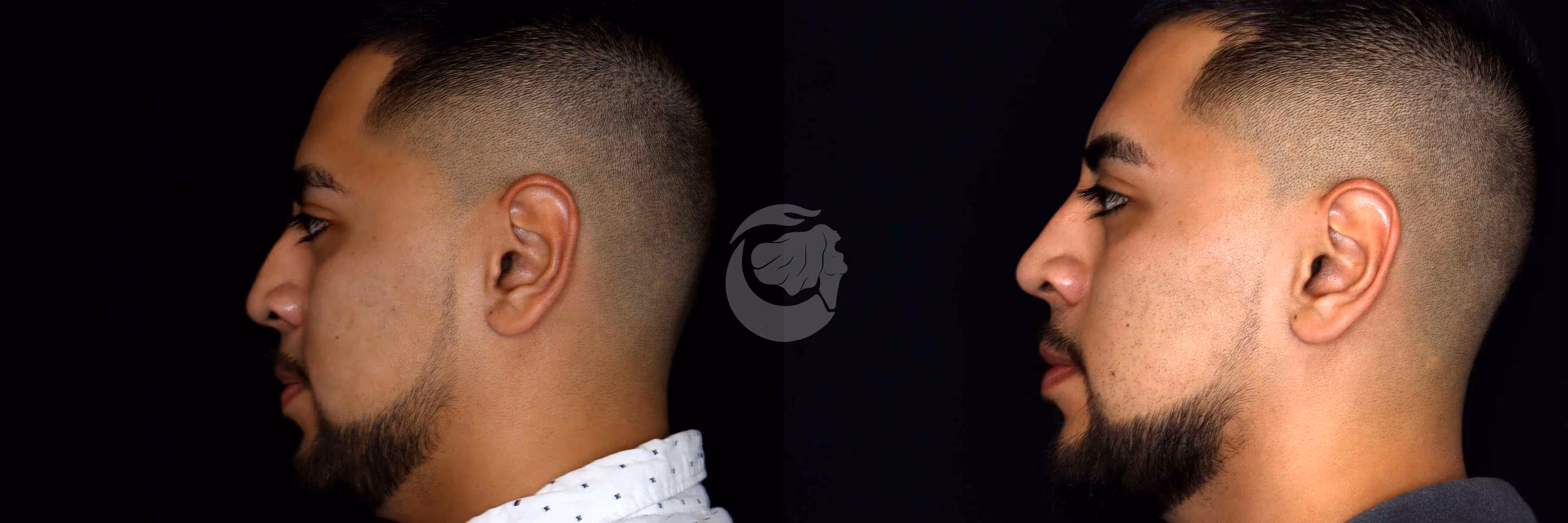 Before And After Patient Image