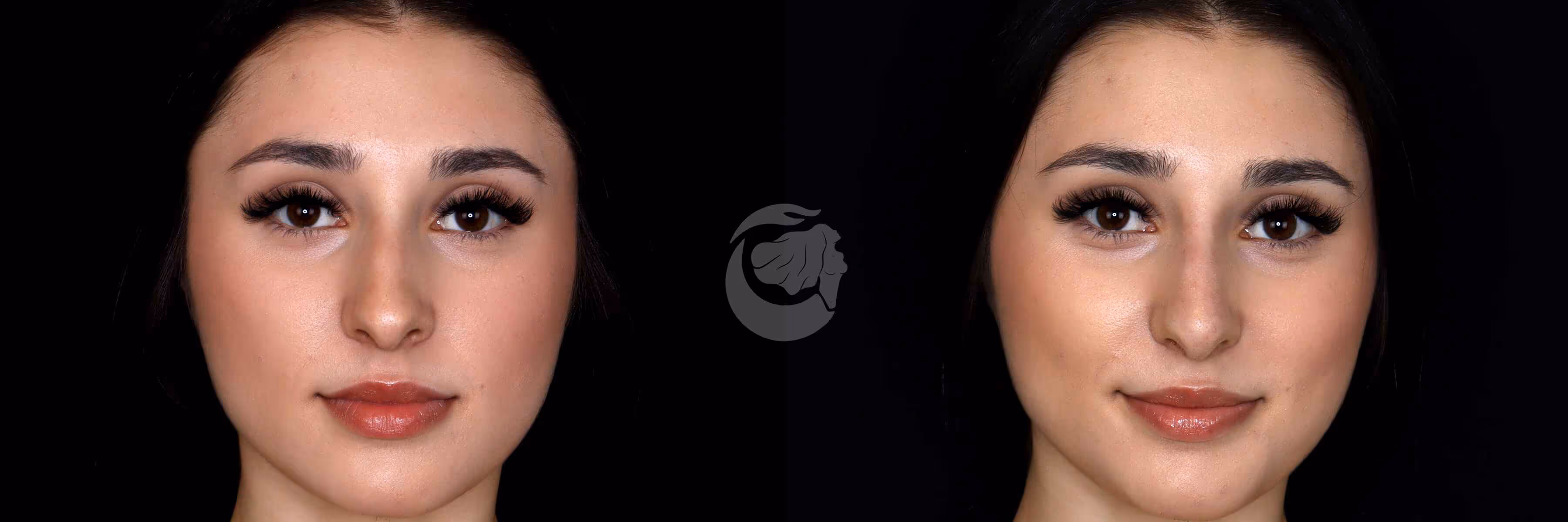 Before And After Patient Image