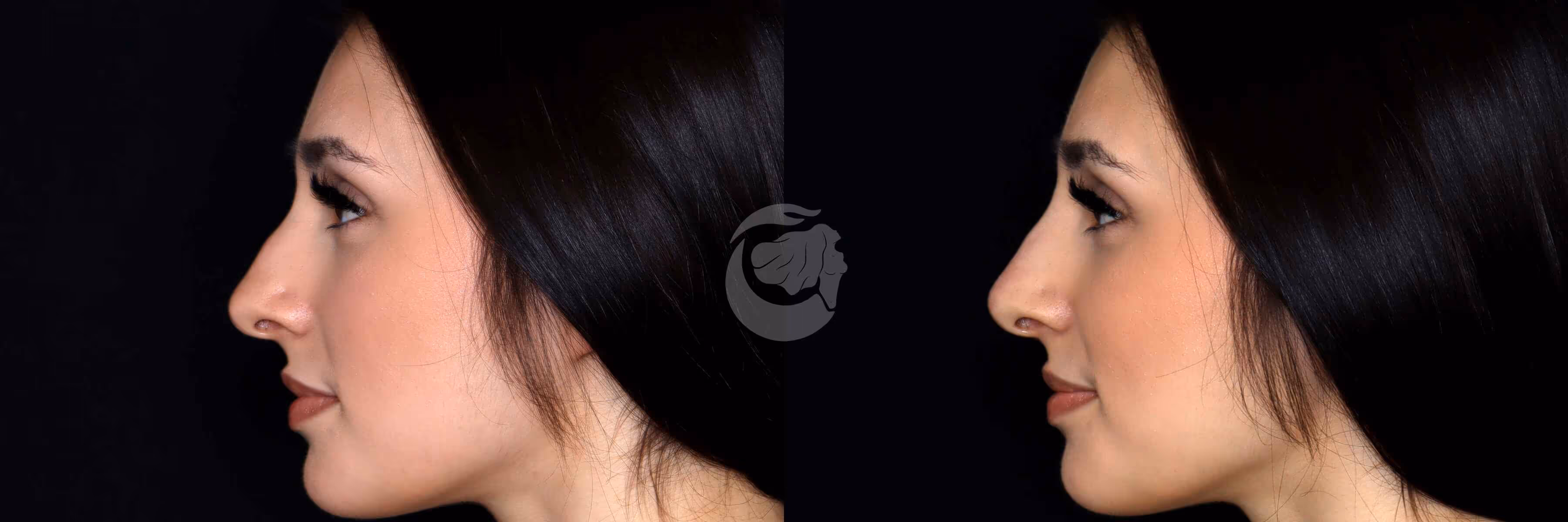 Before And After Patient Image