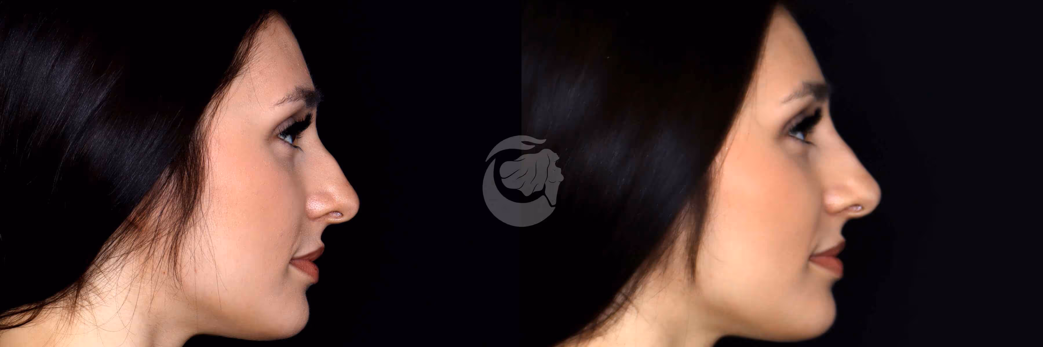 Before And After Patient Image