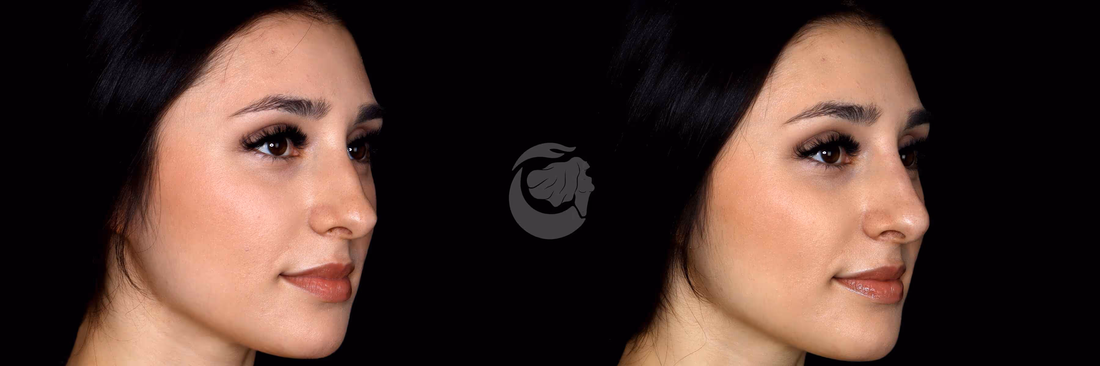 Before And After Patient Image