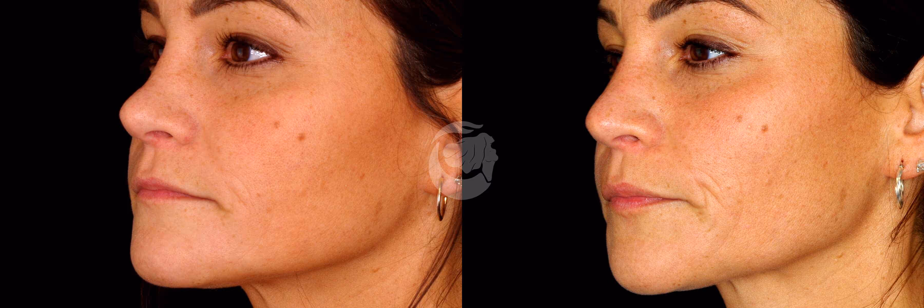 Before And After Patient Image