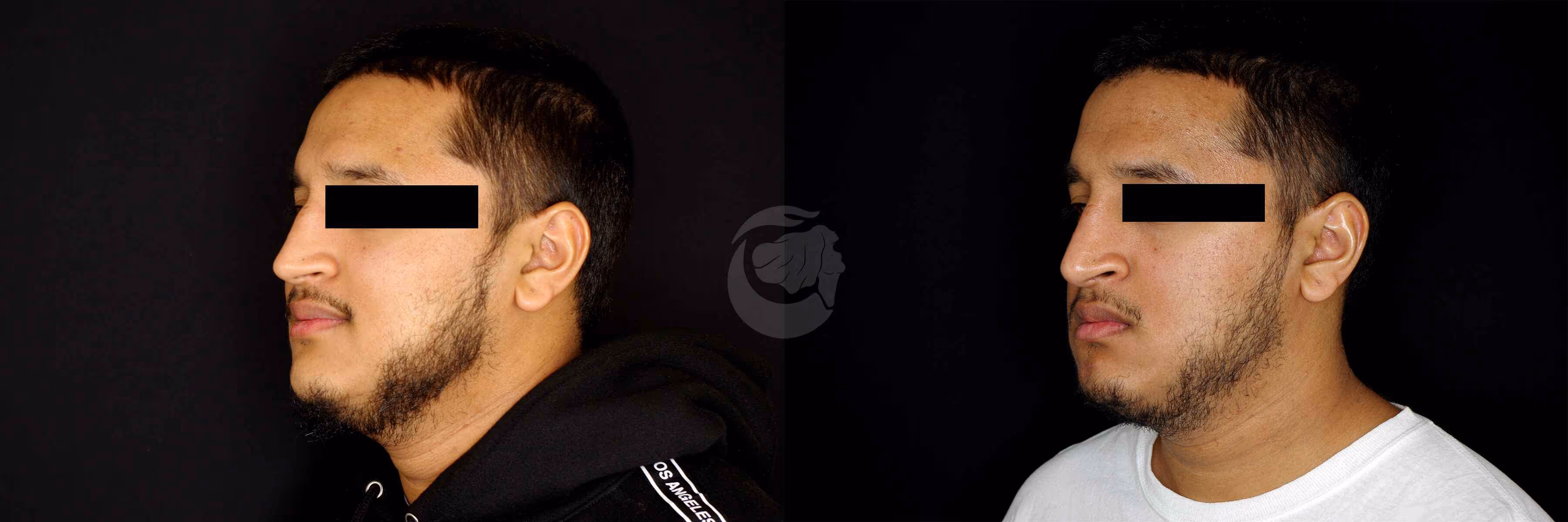 Before And After Patient Image