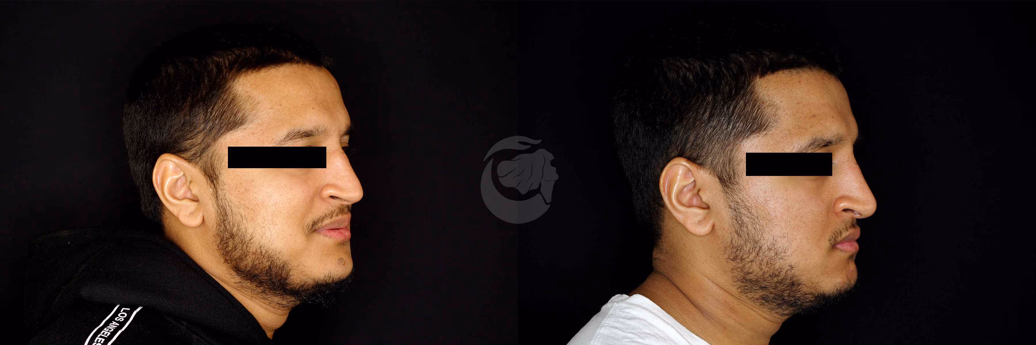 Before And After Patient Image
