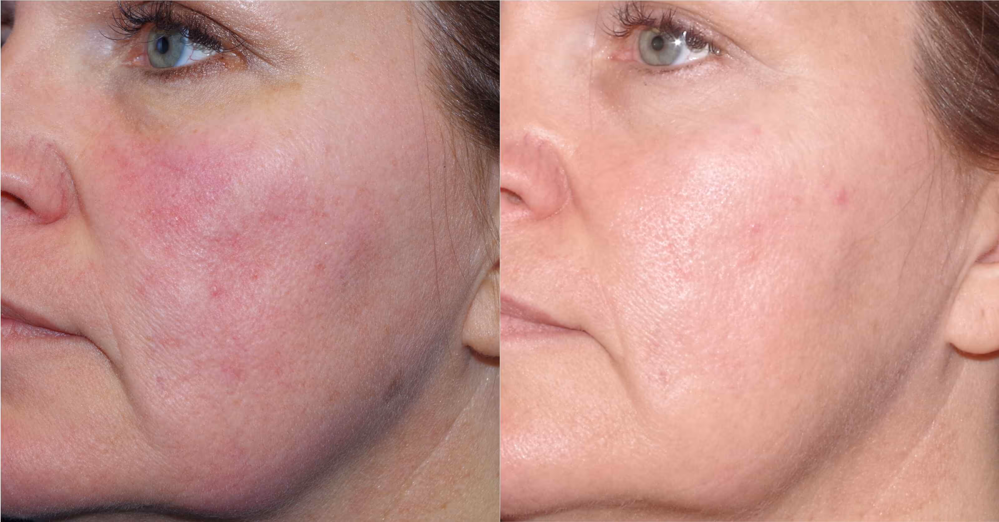 Before And After Patient Image