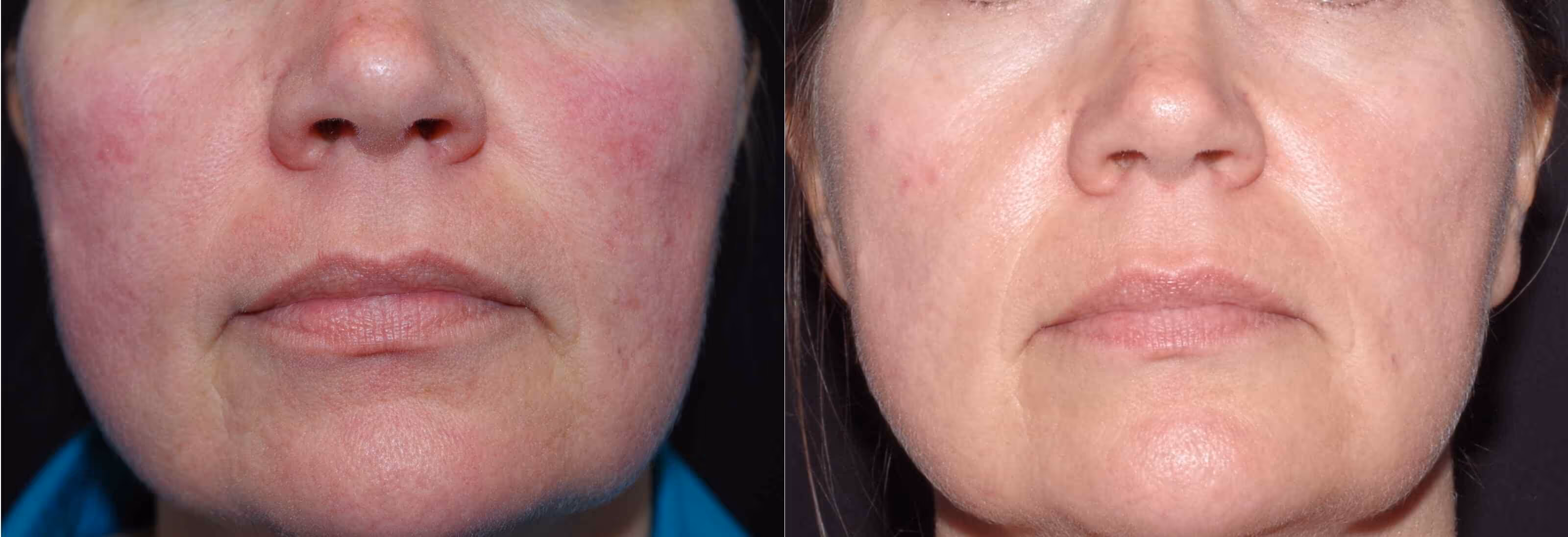 Before And After Patient Image